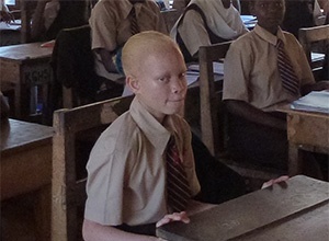 ALBINO’S IN KENIA - INTEGRATIE OF SEGREGATIE